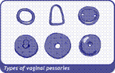 diagram of pessaries