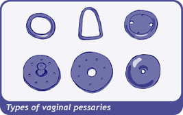 diagram of pessaries